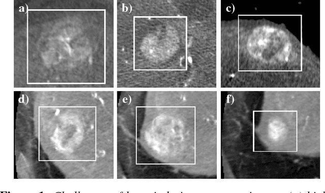 Figure 1 for UI-Net: Interactive Artificial Neural Networks for Iterative Image Segmentation Based on a User Model