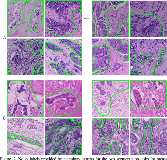Figure 2 for Logical Assessment Formula and its Principles for Evaluations without Accurate Ground-Truth Labels