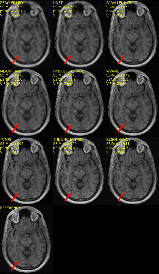 Figure 2 for Multi-channel MR Reconstruction (MC-MRRec) Challenge -- Comparing Accelerated MR Reconstruction Models and Assessing Their Genereralizability to Datasets Collected with Different Coils