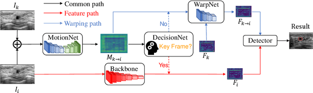Figure 3 for Semi-supervised Breast Lesion Detection in Ultrasound Video Based on Temporal Coherence