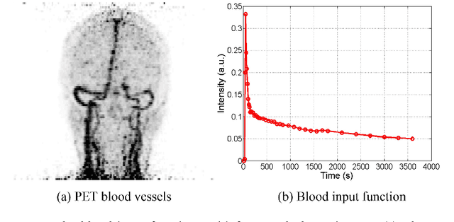 Figure 3 for Clinically Translatable Direct Patlak Reconstruction from Dynamic PET with Motion Correction Using Convolutional Neural Network