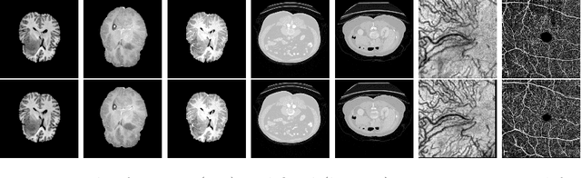Figure 1 for A Meta-Learning Approach for Medical Image Registration