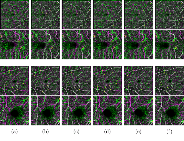Figure 4 for A Meta-Learning Approach for Medical Image Registration