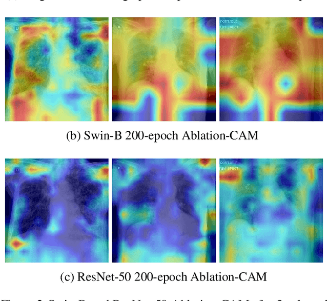 Figure 4 for Towards Trustworthy Healthcare AI: Attention-Based Feature Learning for COVID-19 Screening With Chest Radiography