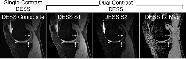 Figure 1 for Deep Learning Super-Resolution Enables Rapid Simultaneous Morphological and Quantitative Magnetic Resonance Imaging