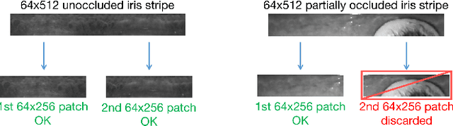 Figure 2 for Post-Mortem Iris Recognition Resistant to Biological Eye Decay Processes