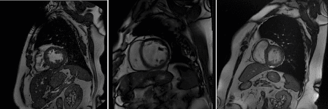Figure 1 for Domain-Adversarial Learning for Multi-Centre, Multi-Vendor, and Multi-Disease Cardiac MR Image Segmentation