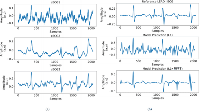 Figure 2 for Deep Network for Capacitive ECG Denoising