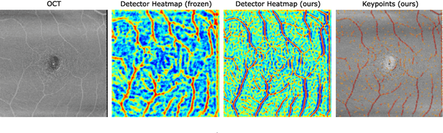 Figure 3 for Multi-modal Retinal Image Registration Using a Keypoint-Based Vessel Structure Aligning Network