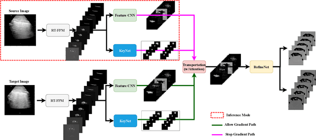 Figure 1 for Physics Driven Domain Specific Transporter Framework with Attention Mechanism for Ultrasound Imaging