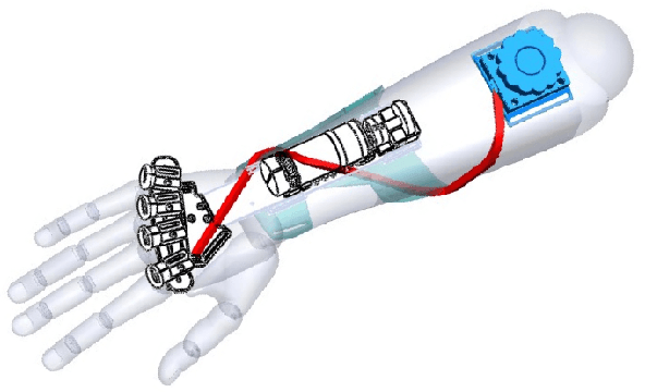 Figure 2 for Design of Spiral-Cable Forearm Exoskeleton to Provide Supination Adjustment for Hemiparetic Stroke Subjects