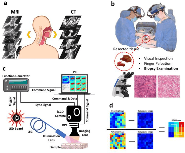 Figure 1 for Dynamic optical contrast imaging for real-time delineation of tumor resection margins using head and neck cancer as a model