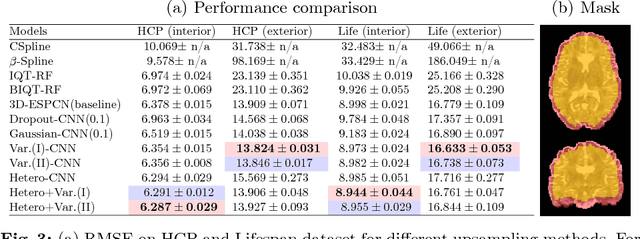 Figure 3 for Bayesian Image Quality Transfer with CNNs: Exploring Uncertainty in dMRI Super-Resolution