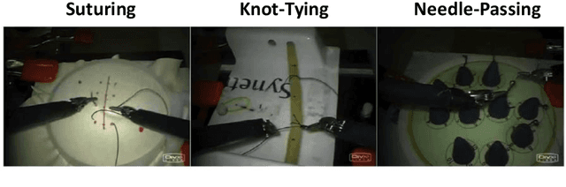 Figure 4 for Automated Surgical Skill Assessment in RMIS Training