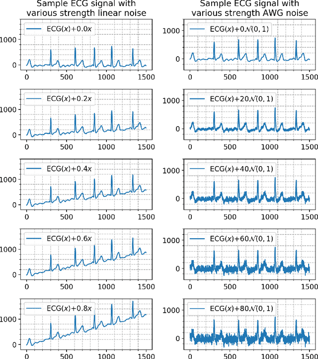 Figure 1 for The Effect of Various Strengths of Noises and Data Augmentations on Classification of Short Single-Lead ECG Signals Using Deep Neural Networks