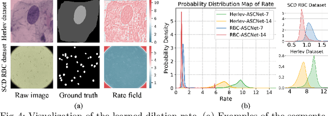 Figure 4 for ASCNet: Adaptive-Scale Convolutional Neural Networks for Multi-Scale Feature Learning