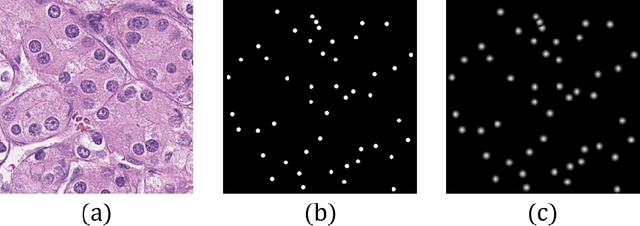 Figure 2 for W-Net: A Two-Stage Convolutional Network for Nucleus Detection in Histopathology Image