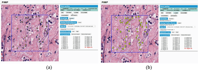 Figure 3 for W-Net: A Two-Stage Convolutional Network for Nucleus Detection in Histopathology Image