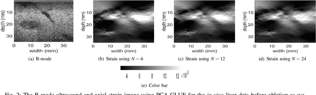 Figure 3 for Fast Strain Estimation and Frame Selection in Ultrasound Elastography using Machine Learning