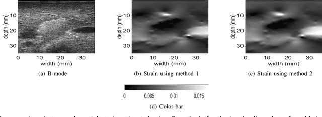Figure 2 for Fast Strain Estimation and Frame Selection in Ultrasound Elastography using Machine Learning