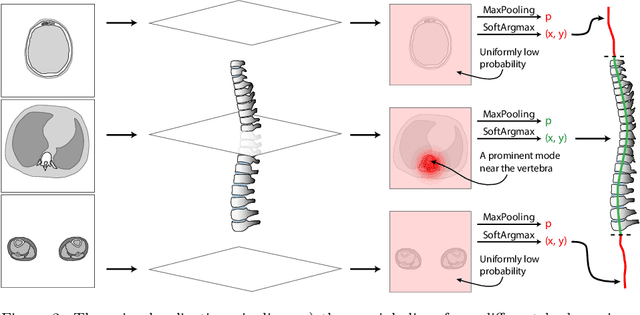 Figure 3 for Interpretable Vertebral Fracture Quantification via Anchor-Free Landmarks Localization