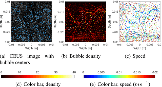 Figure 2 for Analytic Optimization-Based Microbubble Tracking in Ultrasound Super-Resolution Microscopy