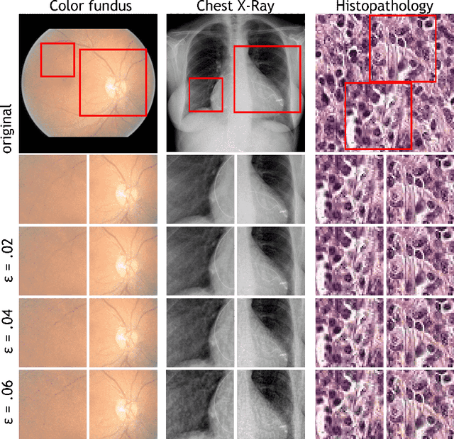 Figure 2 for Adversarial Attack Vulnerability of Medical Image Analysis Systems: Unexplored Factors