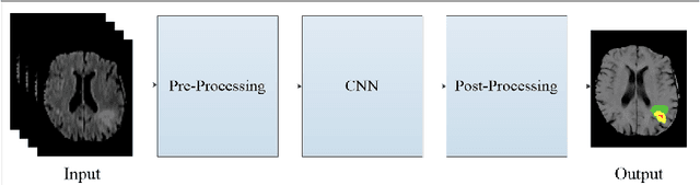 Figure 1 for Segmentation of Glioma Tumors in Brain Using Deep Convolutional Neural Network