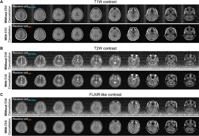 Figure 4 for Robust Electromagnetic Interference (EMI) Elimination via Simultaneous Sensing and Deep Learning Prediction for RF Shielding-free MRI
