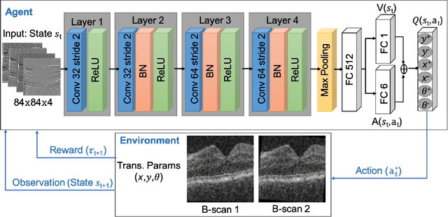 Figure 1 for Dueling Deep Q-Network for Unsupervised Inter-frame Eye Movement Correction in Optical Coherence Tomography Volumes