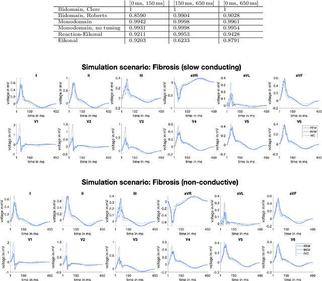 Figure 2 for Comparison of propagation models and forward calculation methods on cellular, tissue and organ scale atrial electrophysiology