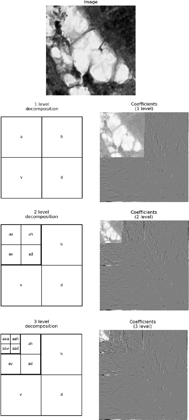 Figure 1 for Texture Characterization of Histopathologic Images Using Ecological Diversity Measures and Discrete Wavelet Transform