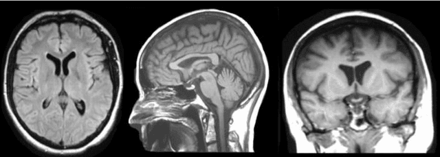 Figure 1 for A Review on End-To-End Methods for Brain Tumor Segmentation and Overall Survival Prediction