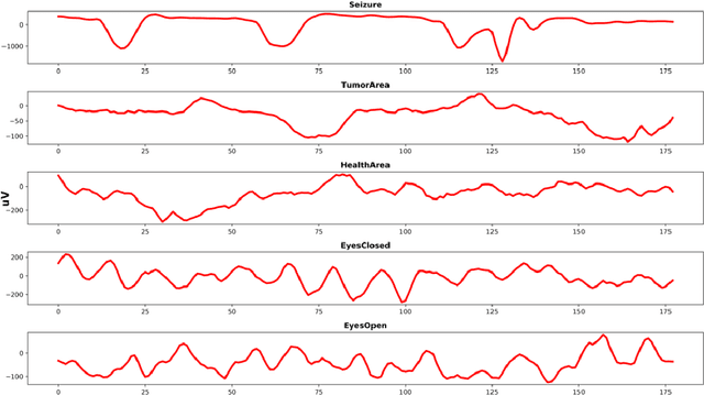 Figure 1 for Using Deep Learning and Machine Learning to Detect Epileptic Seizure with Electroencephalography Data
