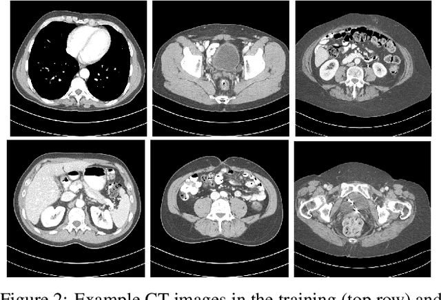 Figure 3 for SUPER Learning: A Supervised-Unsupervised Framework for Low-Dose CT Image Reconstruction