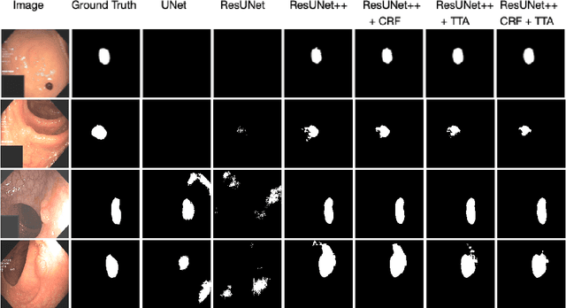 Figure 4 for A Comprehensive Study on Colorectal Polyp Segmentation with ResUNet++, Conditional Random Field and Test-Time Augmentation
