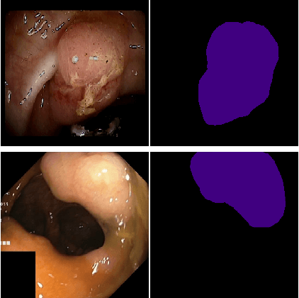 Figure 1 for Ensemble Learning based on Classifier Prediction Confidence and Comprehensive Learning Particle Swarm Optimisation for polyp localisation
