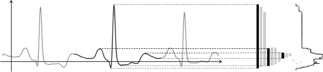 Figure 1 for Topological Data Analysis for Arrhythmia Detection through Modular Neural Networks