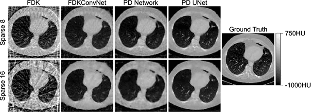 Figure 2 for Primal-Dual UNet for Sparse View Cone Beam Computed Tomography Volume Reconstruction