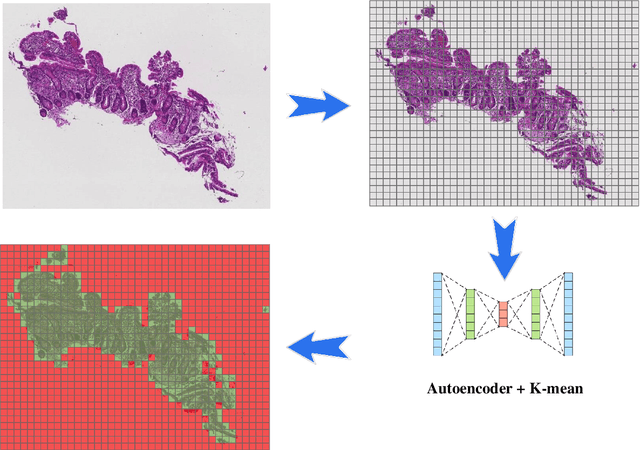 Figure 4 for HMIC: Hierarchical Medical Image Classification, A Deep Learning Approach