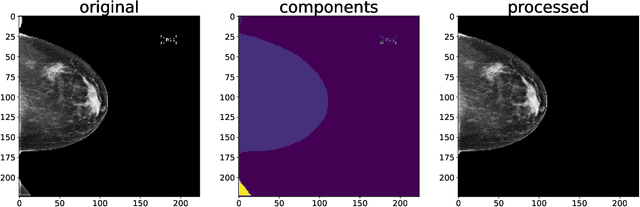 Figure 2 for Three Applications of Conformal Prediction for Rating Breast Density in Mammography