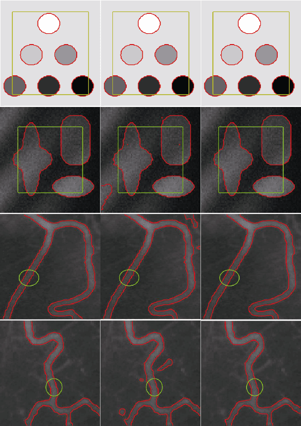 Figure 2 for An Efficient Algorithm for the Piecewise-Smooth Model with Approximately Explicit Solutions
