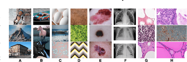 Figure 1 for Cats, not CAT scans: a study of dataset similarity in transfer learning for 2D medical image classification