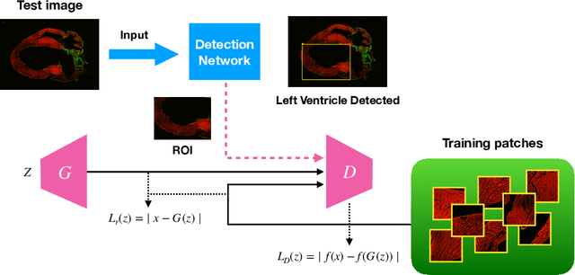 Figure 1 for A One-Shot Learning Framework for Assessment of Fibrillar Collagen from Second Harmonic Generation Images of an Infarcted Myocardium