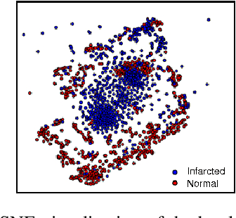 Figure 4 for A One-Shot Learning Framework for Assessment of Fibrillar Collagen from Second Harmonic Generation Images of an Infarcted Myocardium