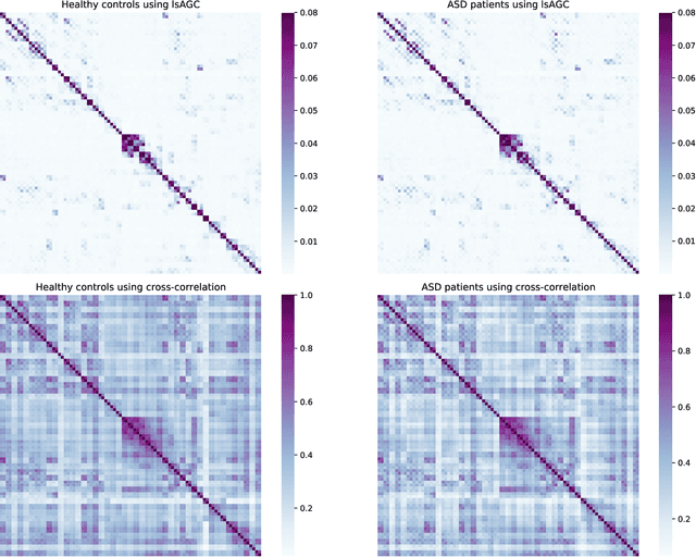 Figure 2 for Large-scale Augmented Granger Causality (lsAGC) for Connectivity Analysis in Complex Systems: From Computer Simulations to Functional MRI (fMRI)