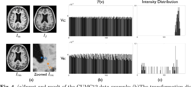 Figure 4 for Misdirected Registration Uncertainty