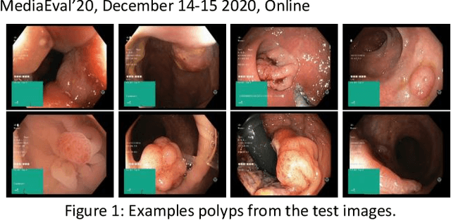 Figure 1 for Refined Deep Neural Network and U-Net for Polyps Segmentation