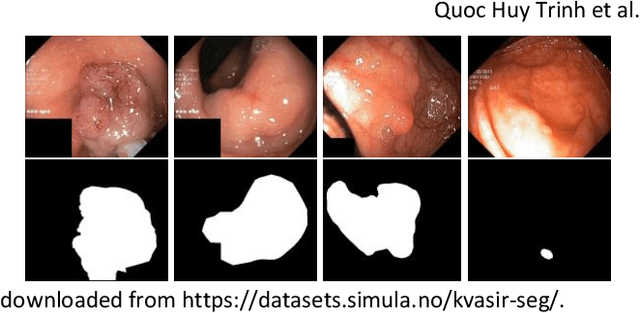Figure 3 for Refined Deep Neural Network and U-Net for Polyps Segmentation