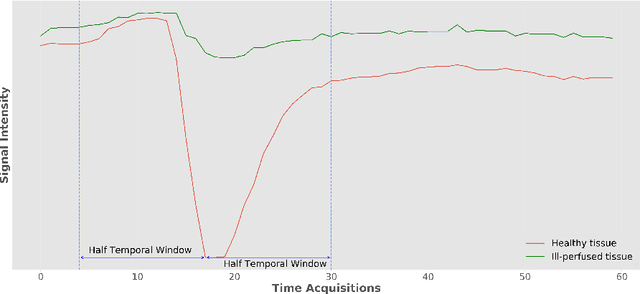 Figure 1 for Enhancing clinical MRI Perfusion maps with data-driven maps of complementary nature for lesion outcome prediction